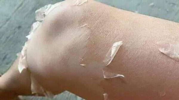 SkeenCare Peeling Lotion for Exfoliate- Refine-and  Reveal in 7 Days. - Image 3